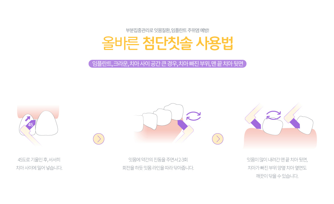 올바른  첨단칫솔 사용법